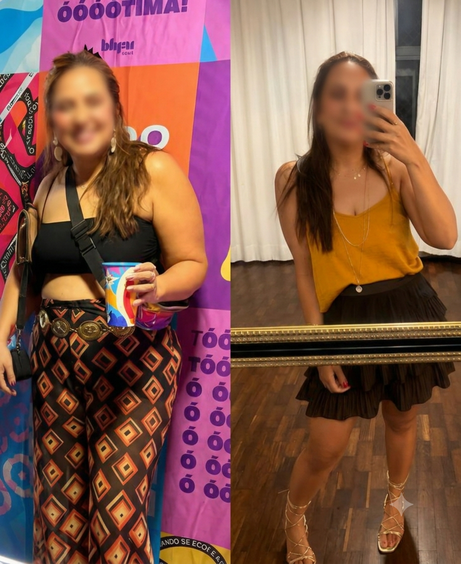 Resultado — Antes e Depois