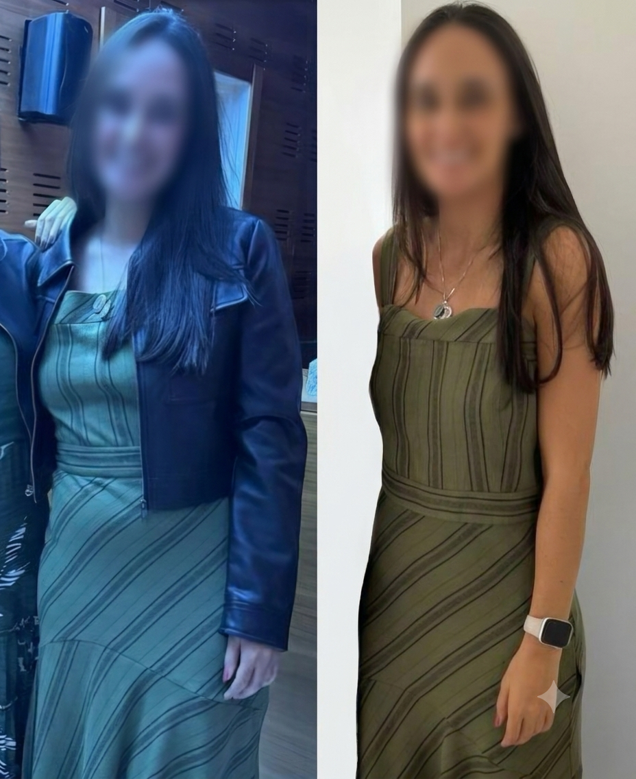 Resultado — Antes e Depois