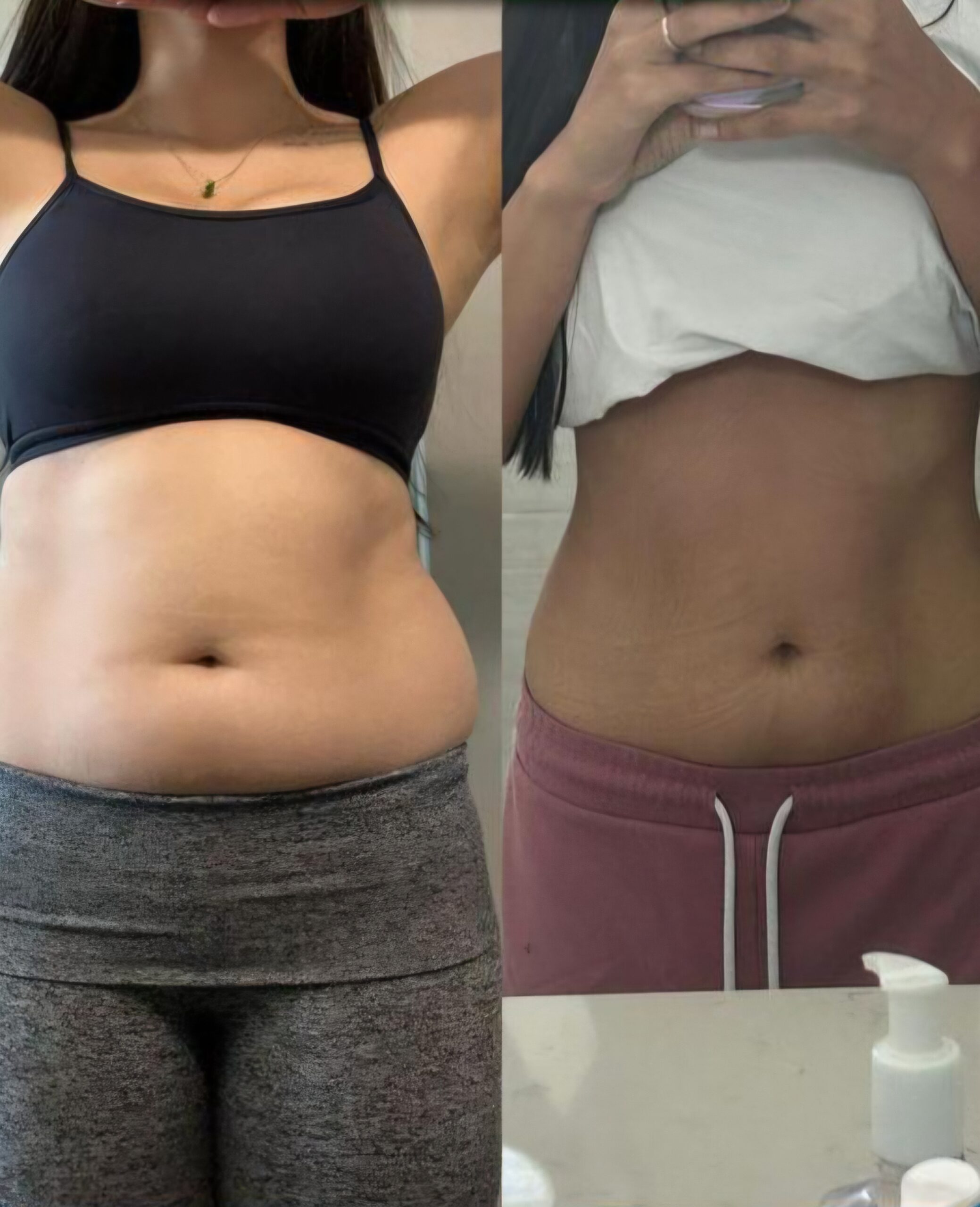 Resultado — Antes e Depois